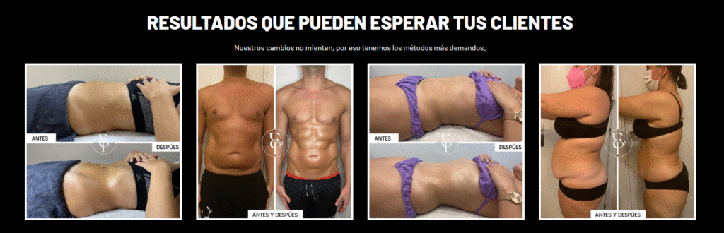 antes y después de la maderoterapia
